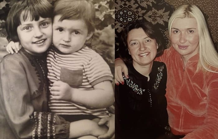 Наталья Максимова до и после операции, с сестрой